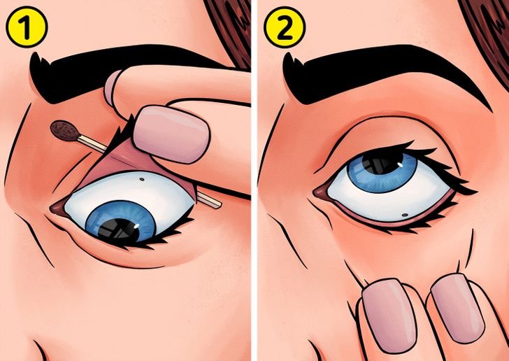 how to get rid of something in your eye